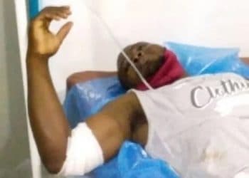 Togo : on en sait un peu plus sur l’agression de Foly Satchivi