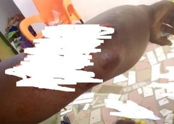 Togo : Foly Satchivi poignardé ce matin (photos)