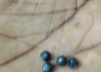 Litige foncier à Tchekpo : des individus ont tiré dans la maison du coordinateur cantonal du MMLK faisant un blessé grave