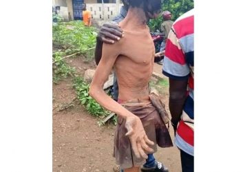 Togo/Evala 2025 : un jeune homme interpelle Faure Gnassingbé avec un geste de la faim (vidéo)